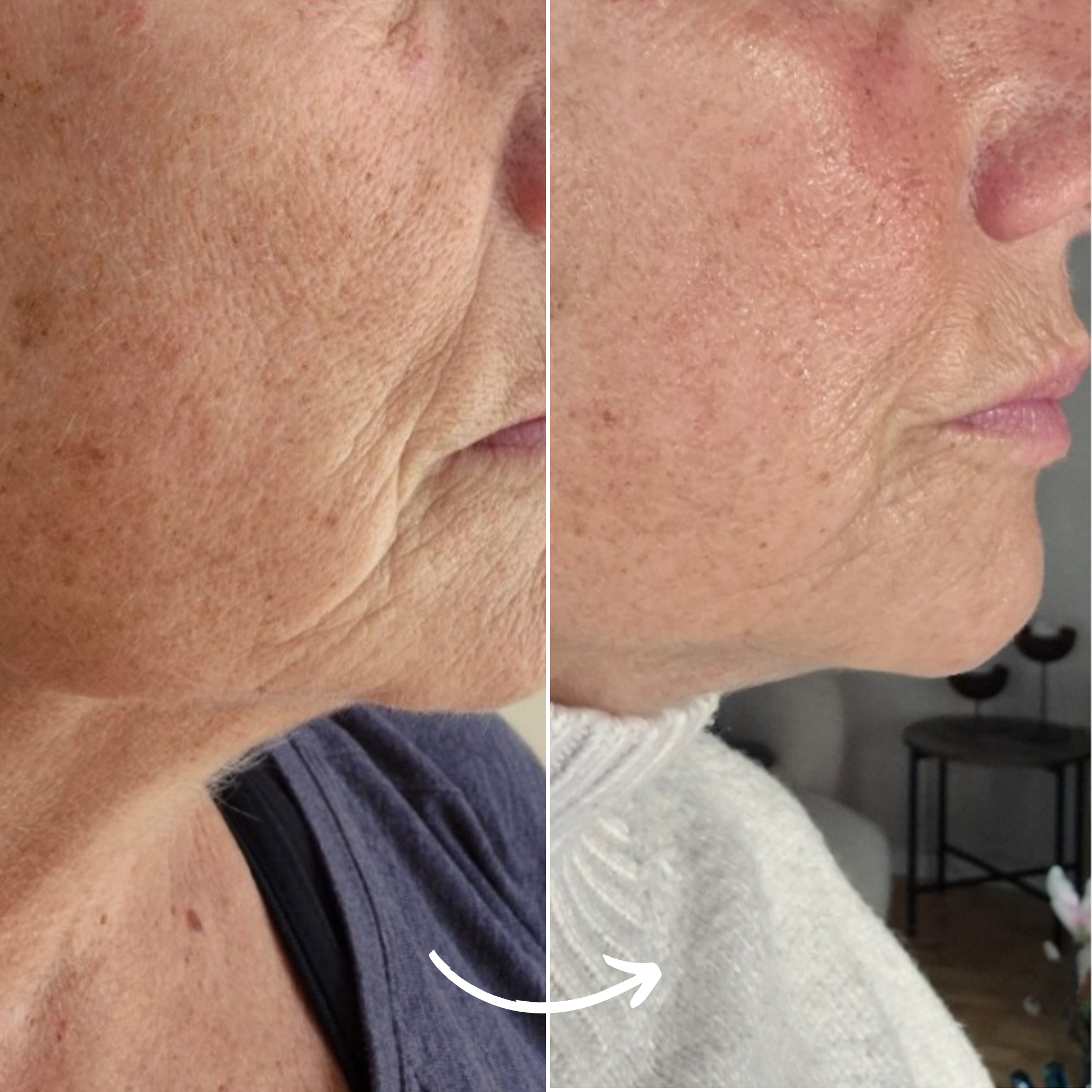 SCANDIFACE Skinboosting LED mask