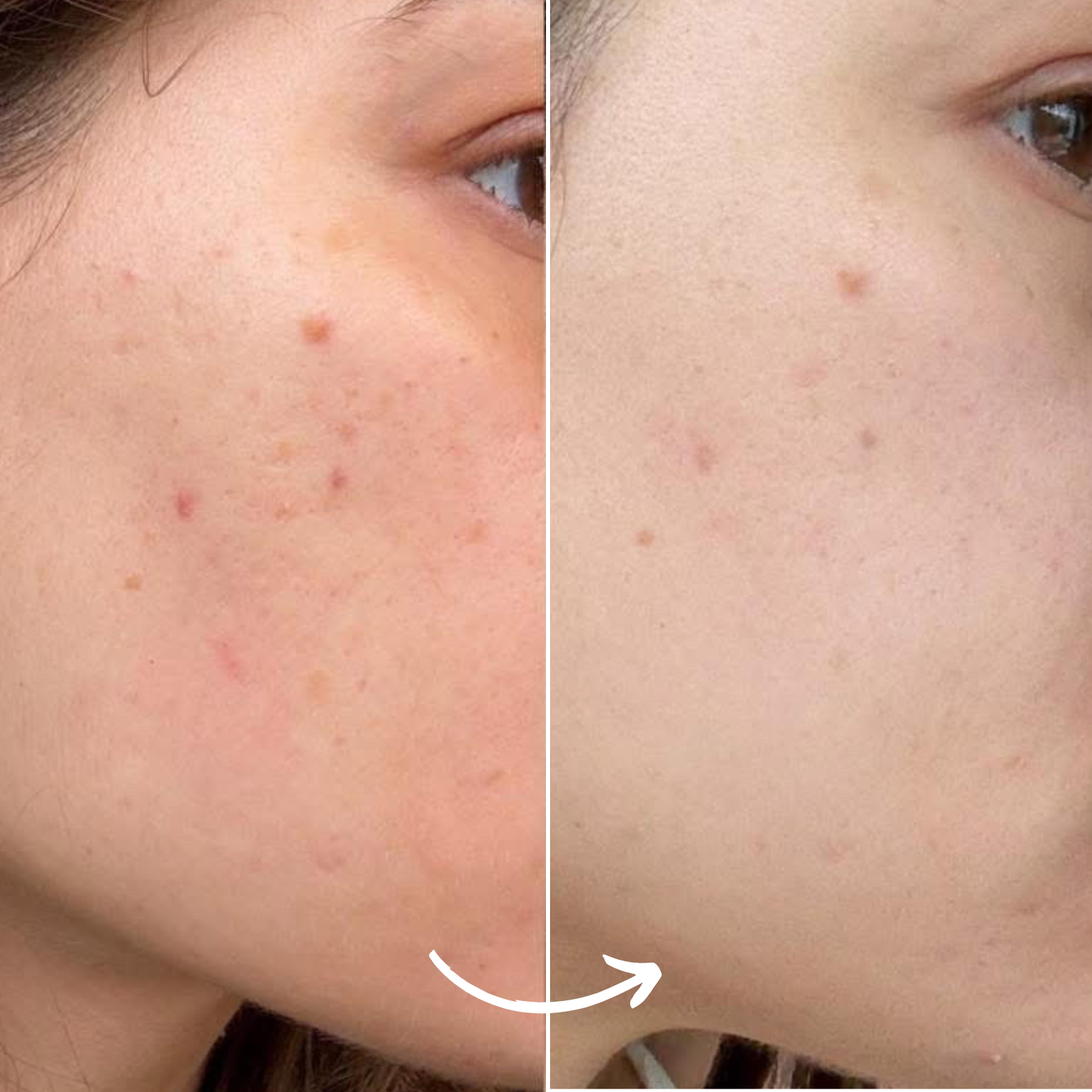 SCANDIFACE Skinboosting LED mask