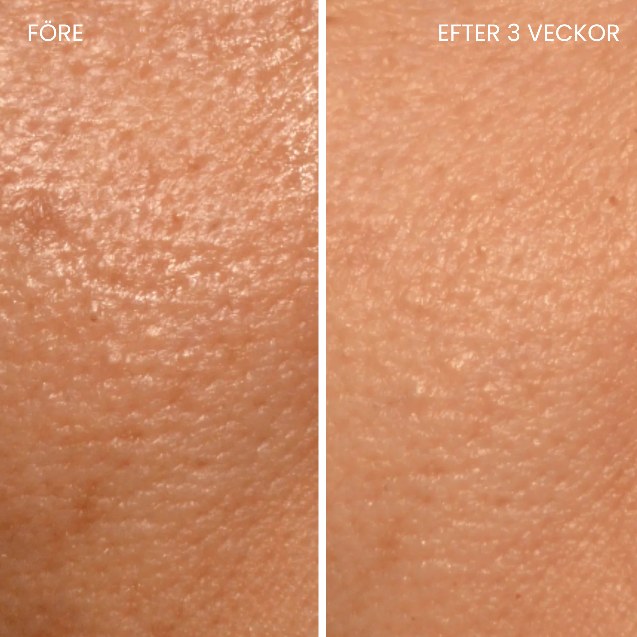 Skinboosting LED mask