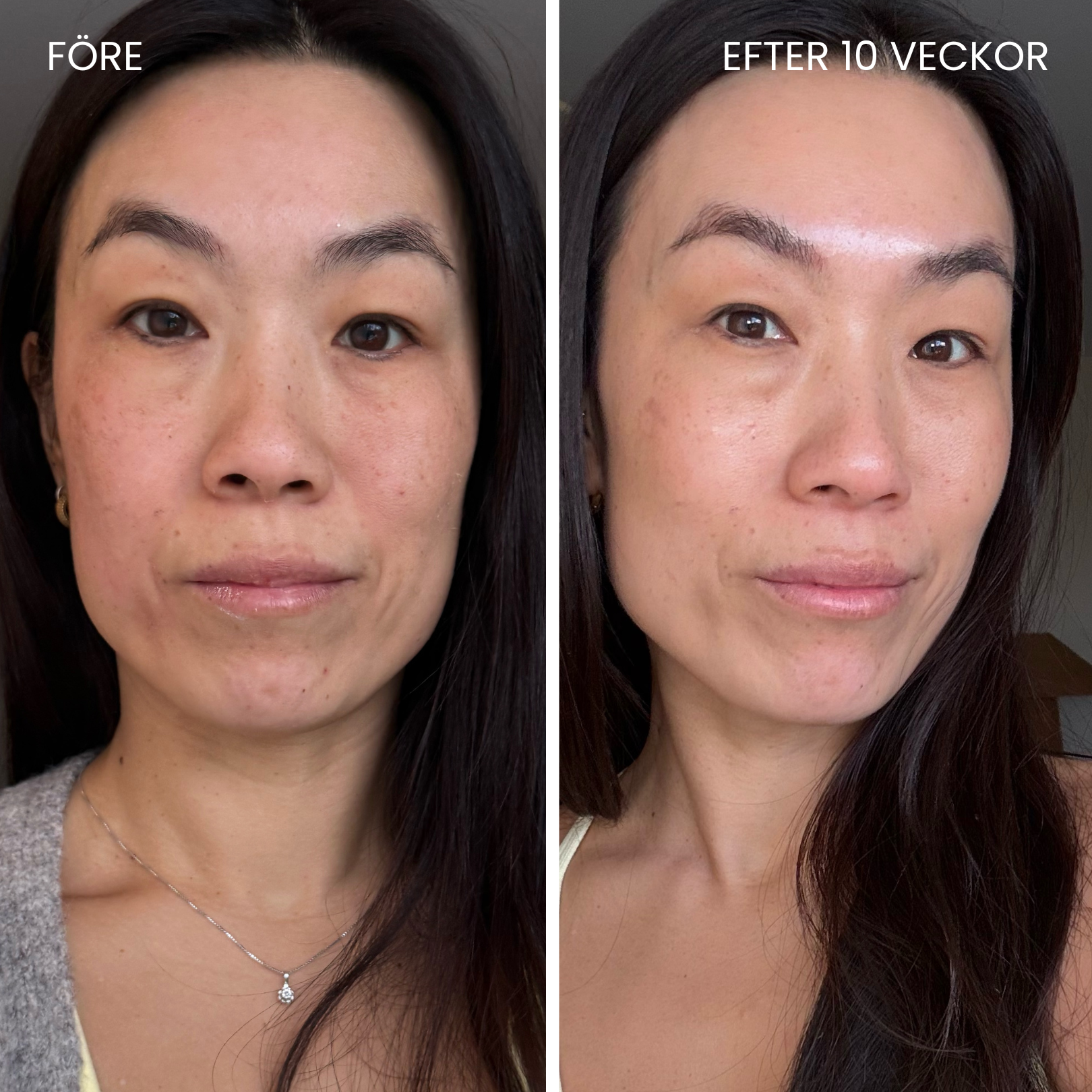 Skinboosting LED mask