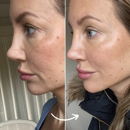 SCANDIFACE Skinboosting LED mask