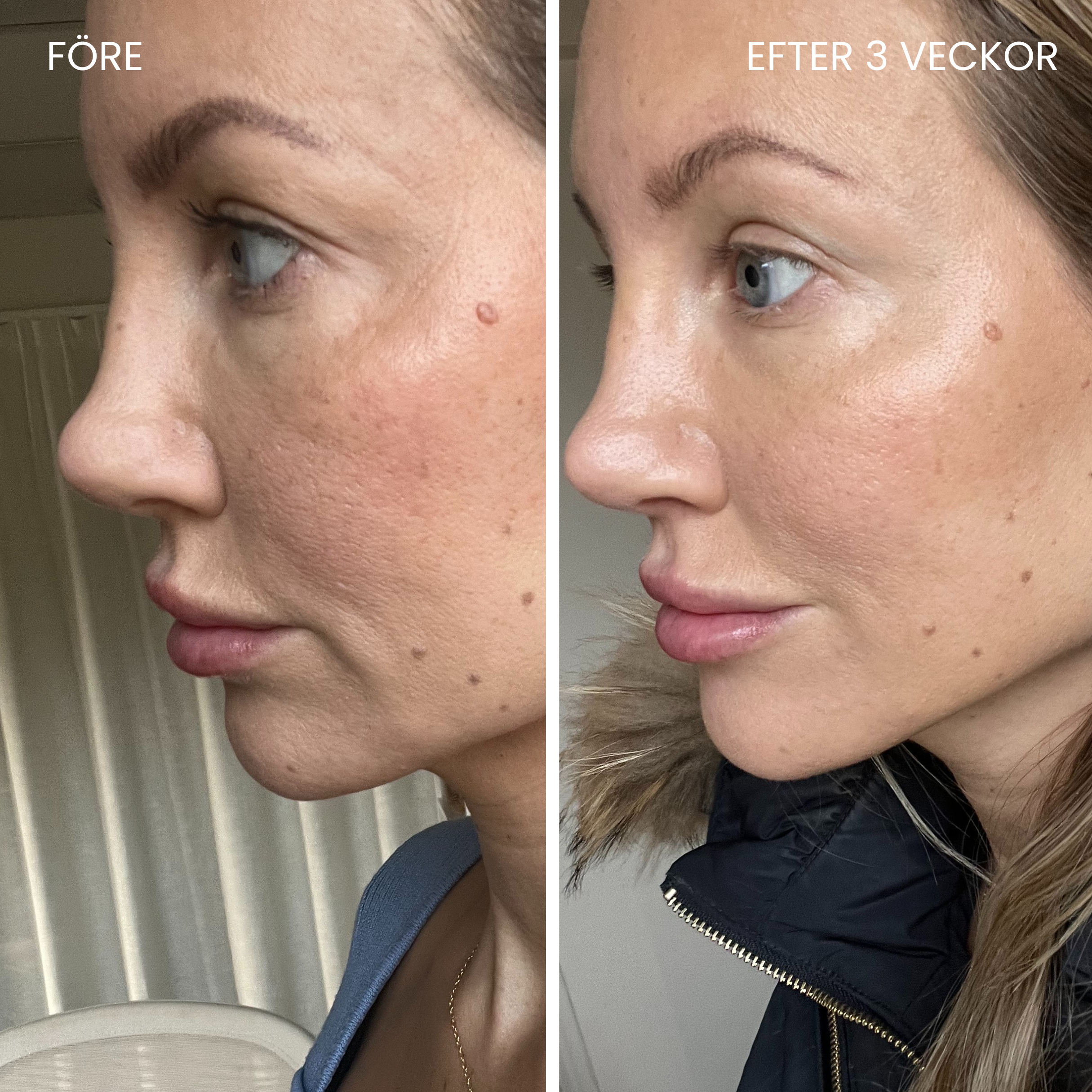 Skinboosting LED mask