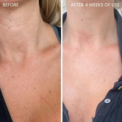 Skinboosting LED collar