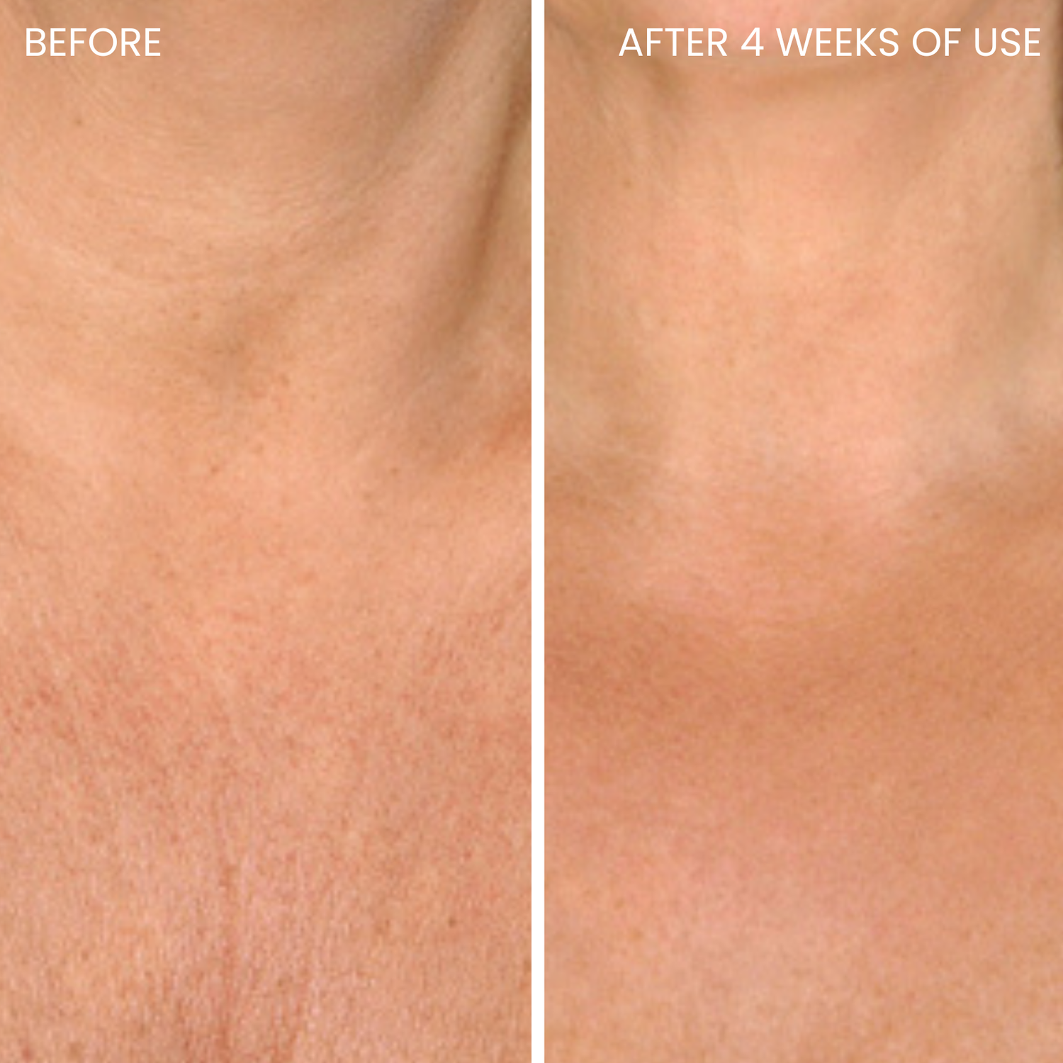 Skinboosting LED collar