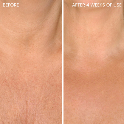 Skinboosting LED collar