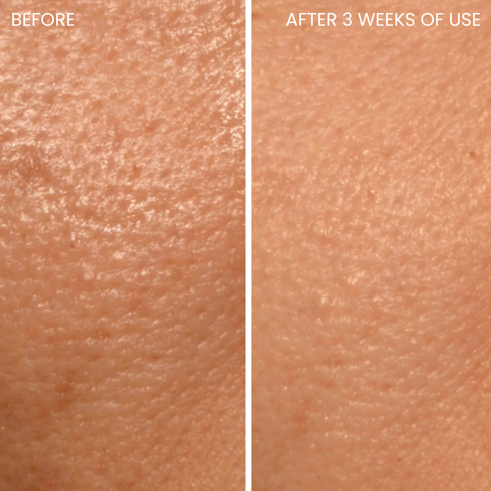 Skin-boosting LED mask