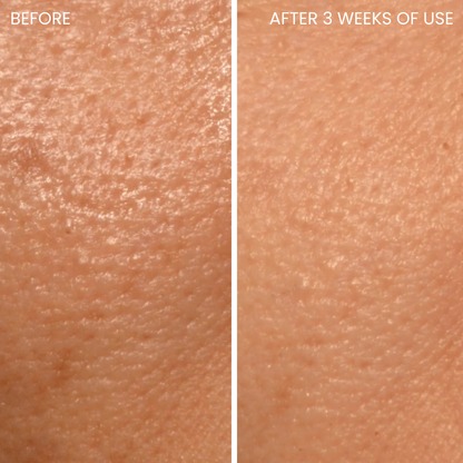 Skinboosting LED mask