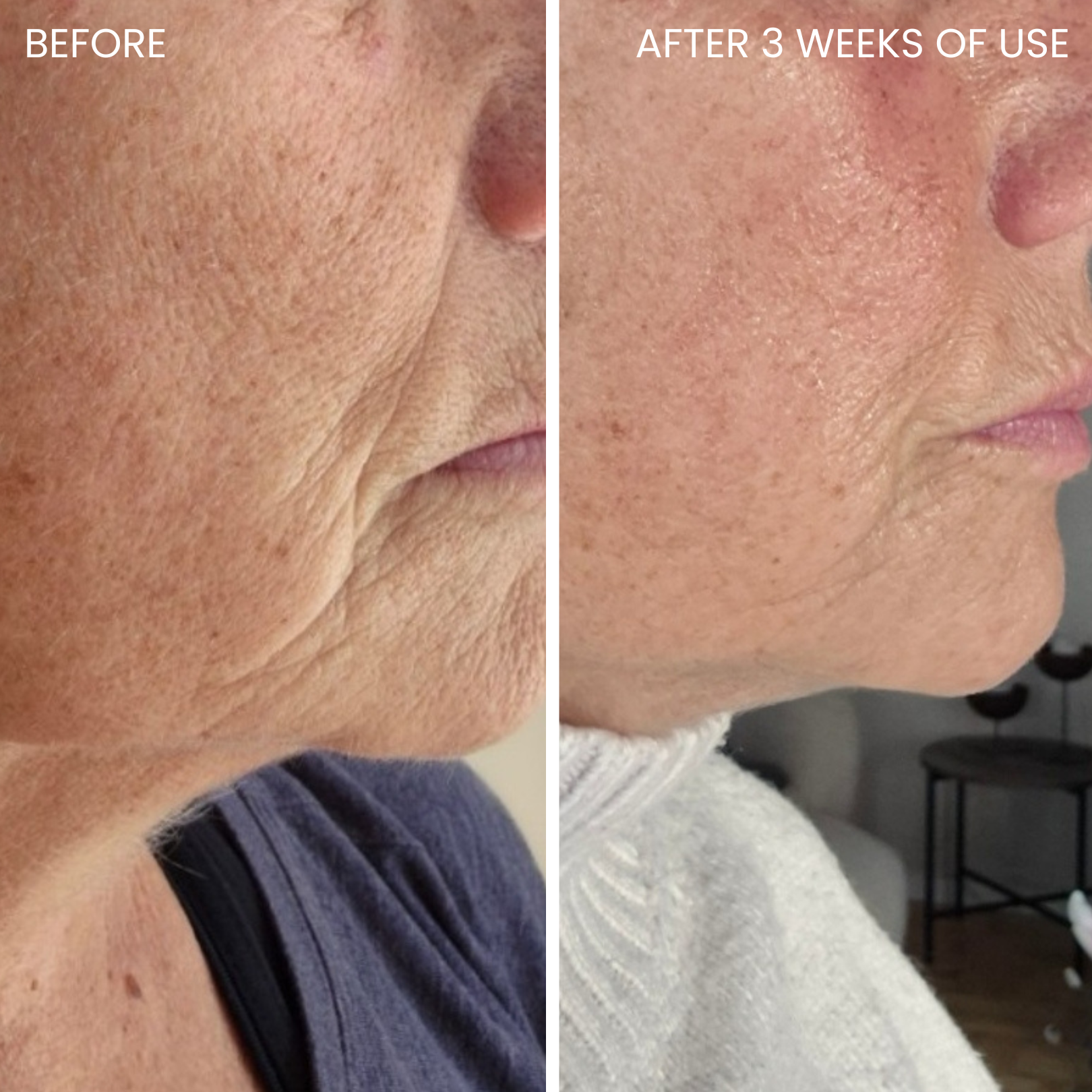 Skin-boosting LED mask