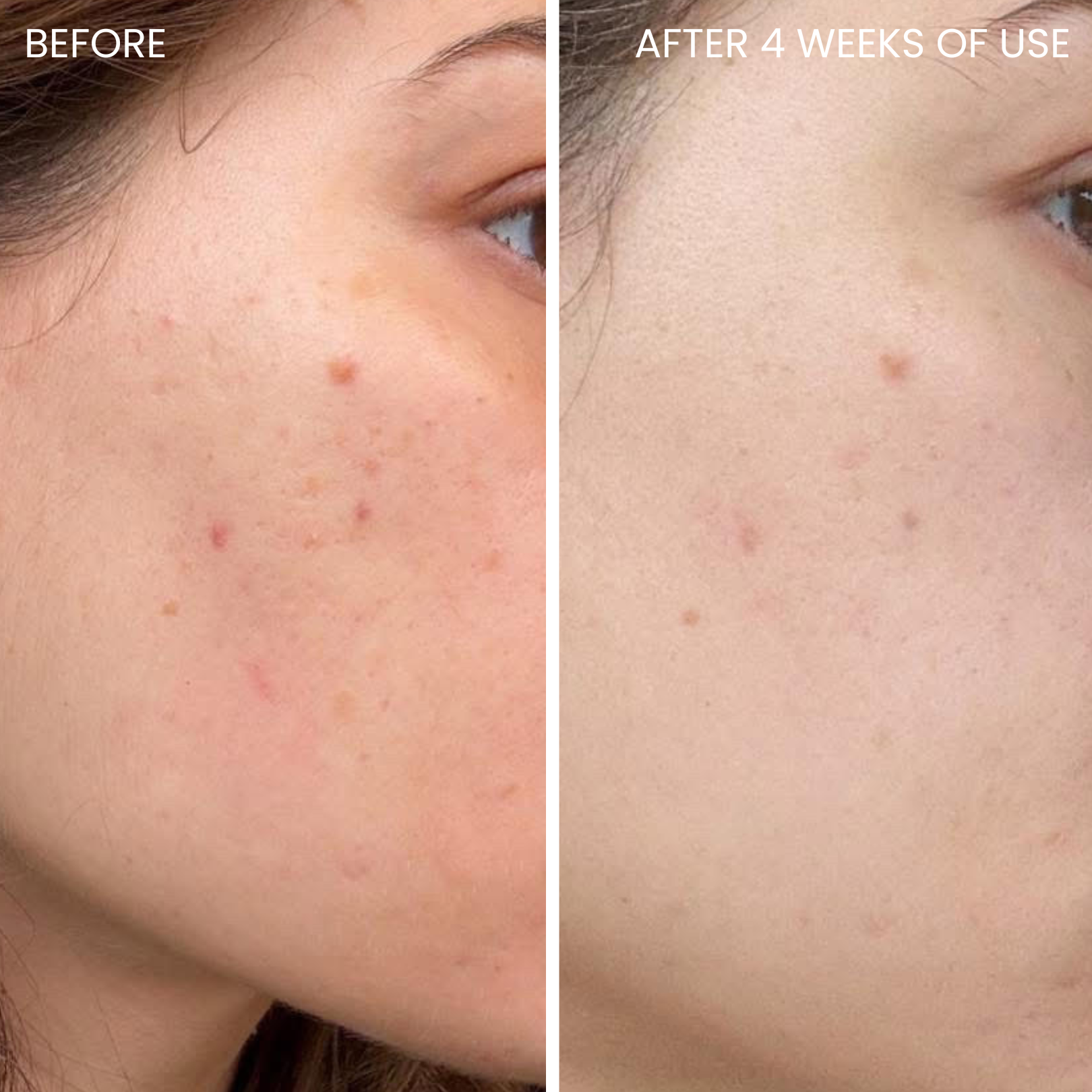 Skin-boosting LED mask