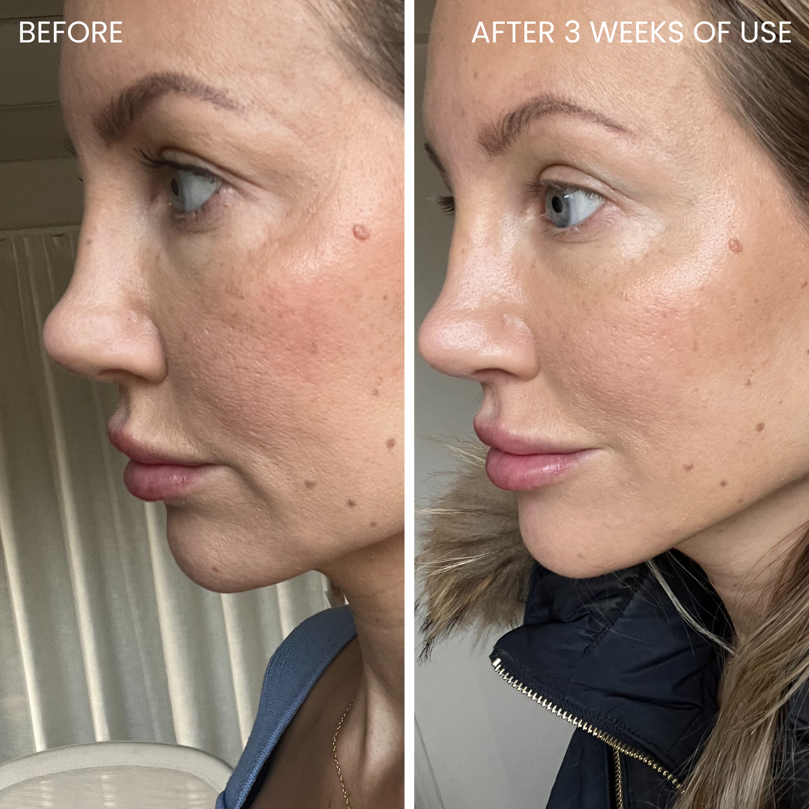 Skin-boosting LED mask